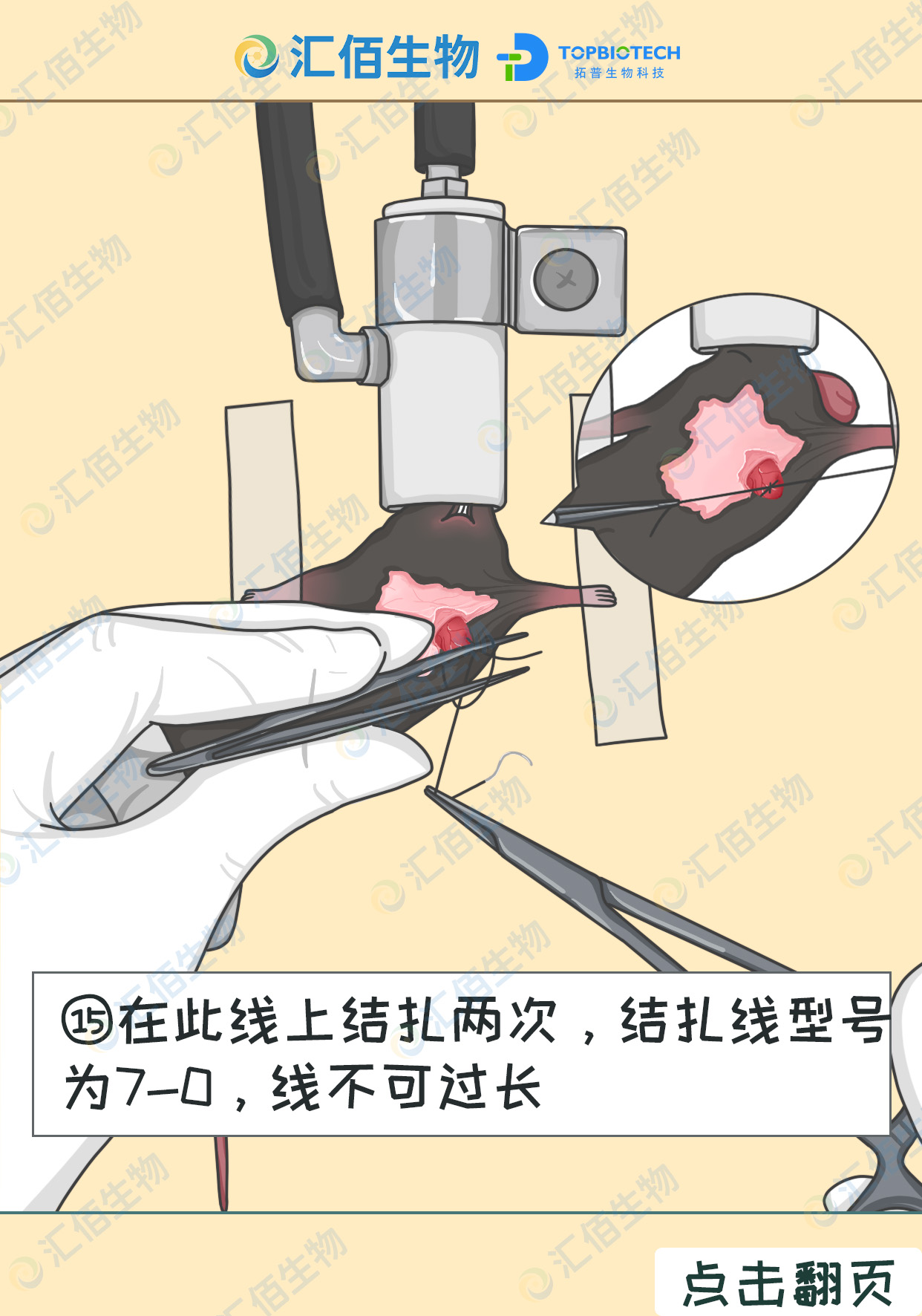 15步骤十五;在此线上结扎两次，结扎线型号 为7-0，线不可过长.jpg